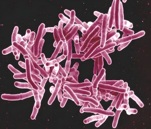 Why you don’t want to get tuberculosis on your penis